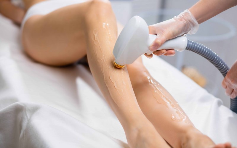 Düzce’de Lazer Epilasyon: Bilmeniz Gerekenler ve En İyi Sonuç İçin İpuçları